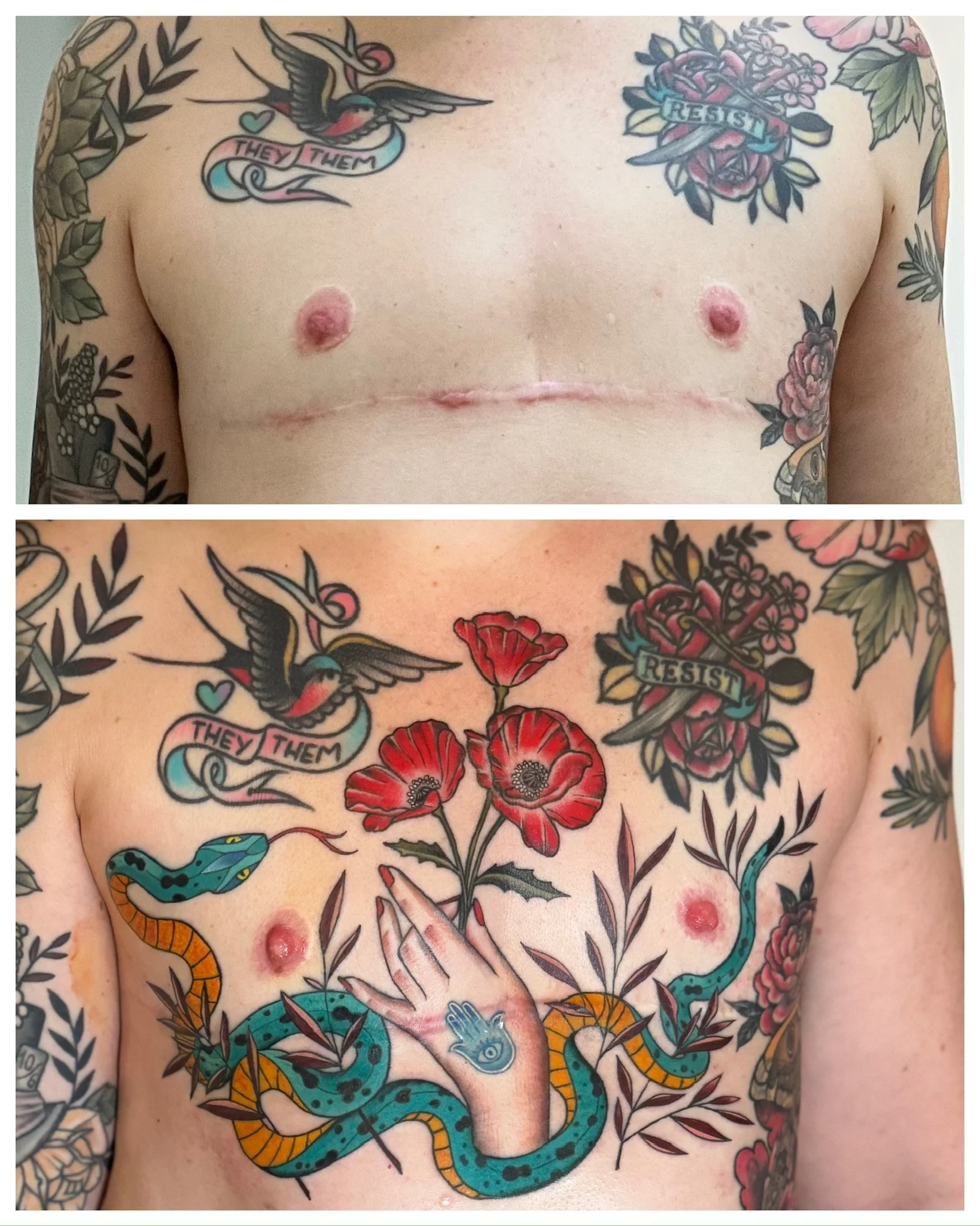Top Surgery Scar Coverup