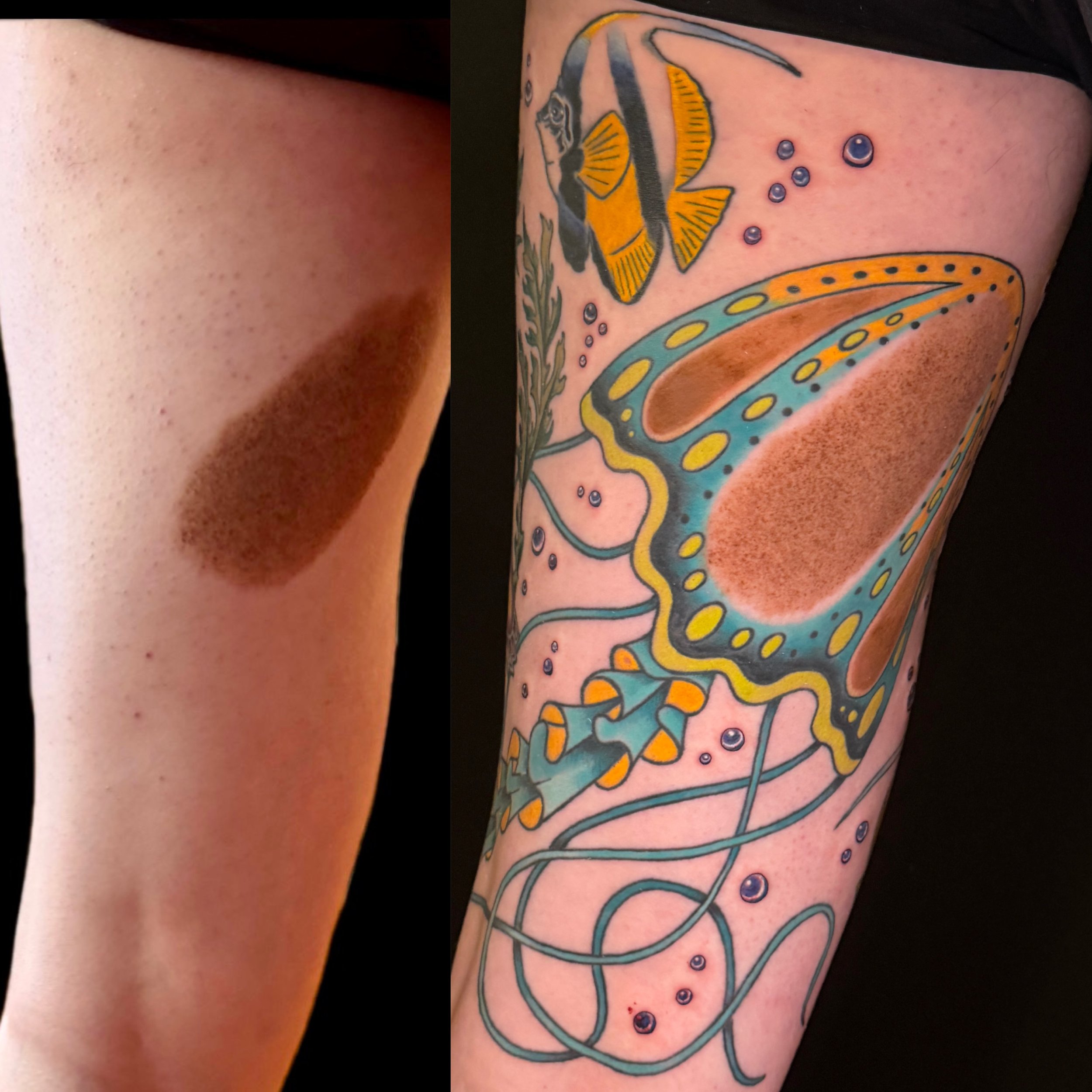 Built a tattoo around a birthmark that couldn't be tattooed over