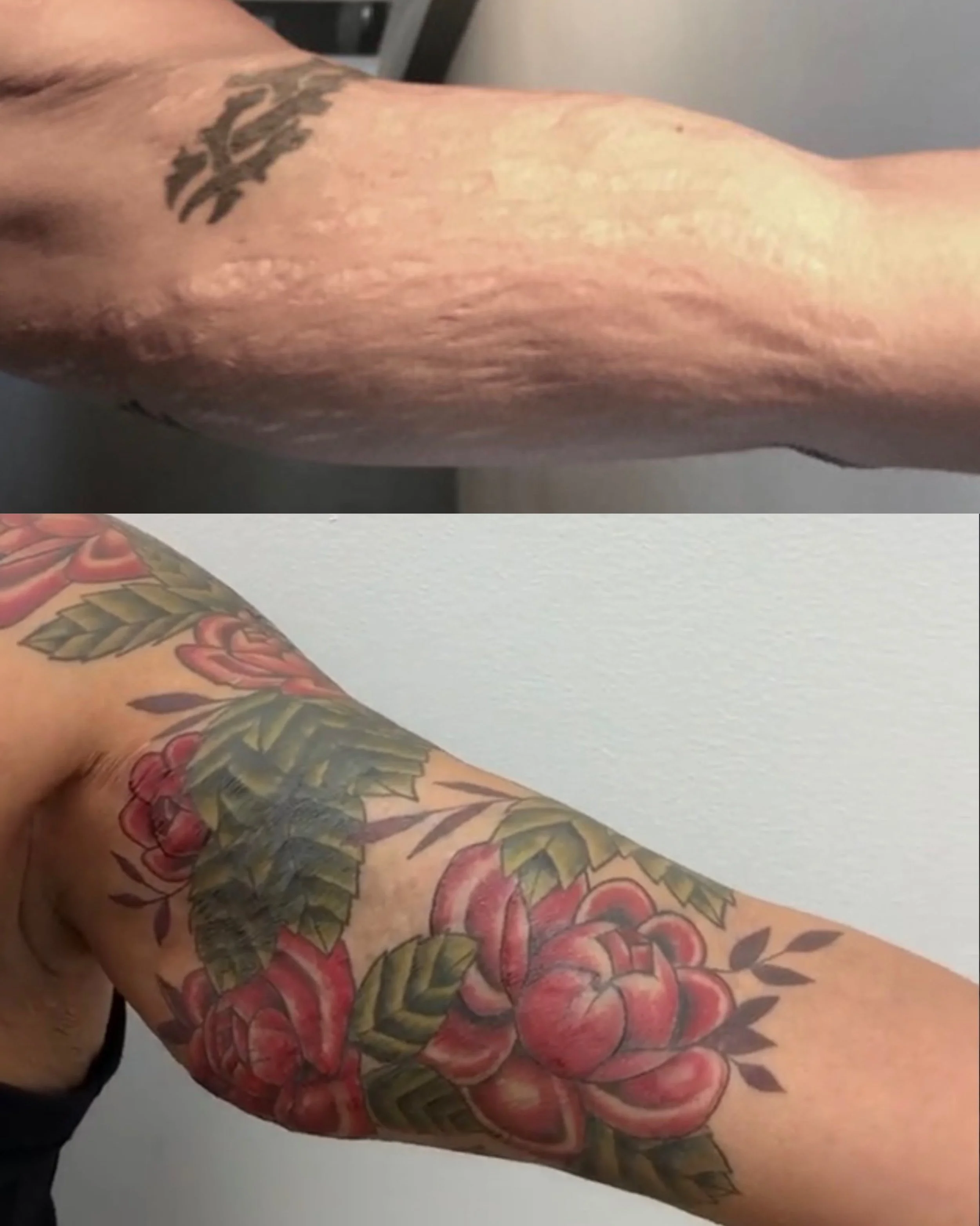 Masking scarring from a reaction to medication 