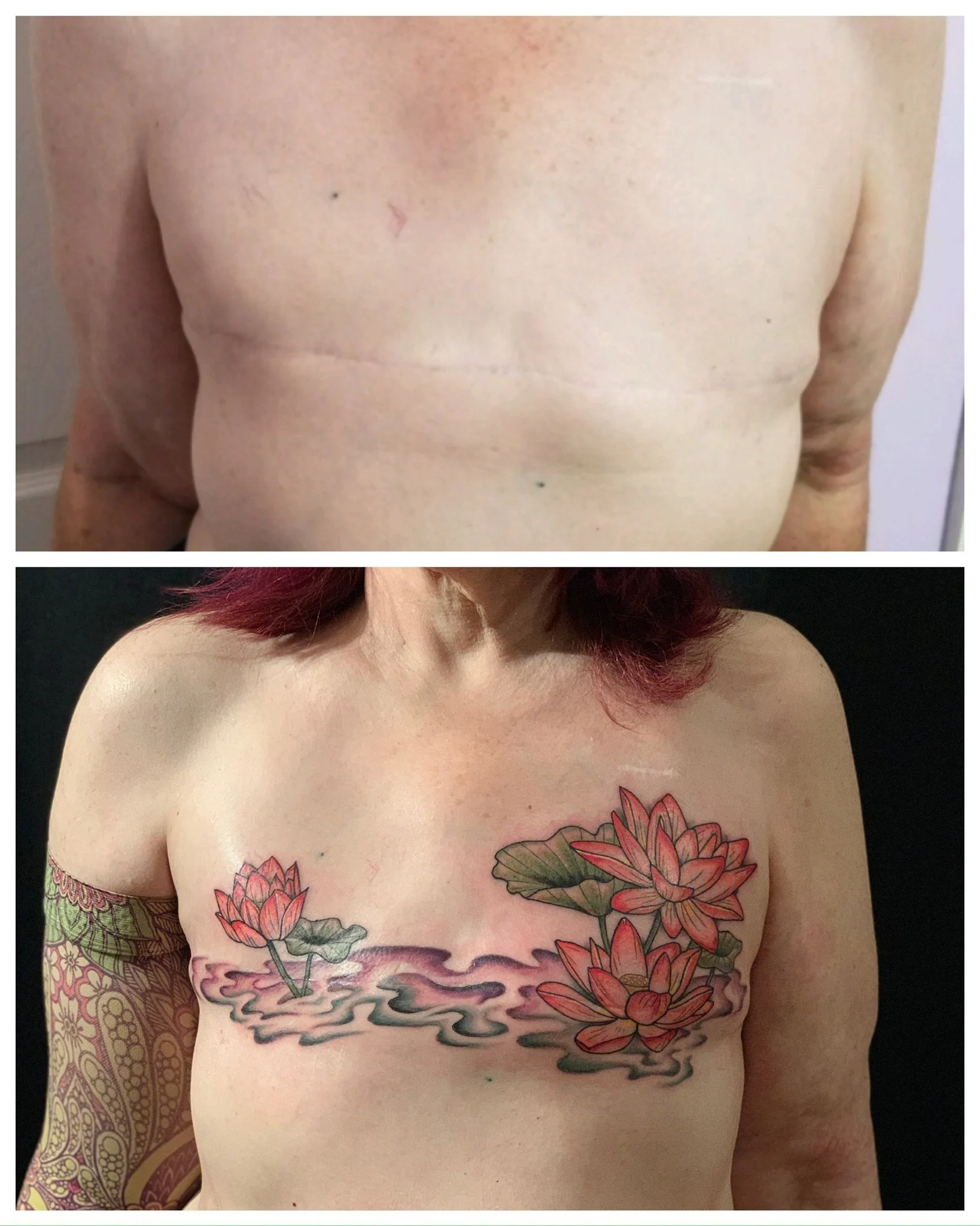 Mastectomy Scar Coverup