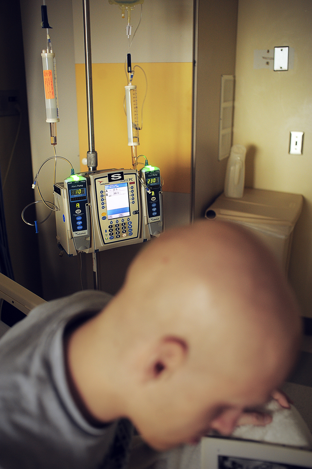  Mitch, diagnosed at age&nbsp;20, &nbsp;was required to undergo approximately 19 alternating weeks of radiation treatment combined with chemotherapy in order to make the possibility of his ailment recede. &nbsp;Mitch suffered from Ewing's Sarcoma, a 