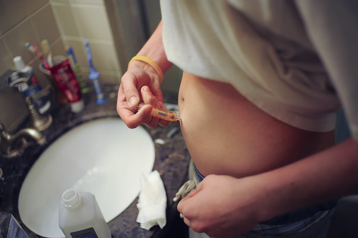  In order for Mitch to be allowed for admittance into the hospital, he is required to administer medication during the weeks that he is home. He is given several types of medication to manage his pain, anxiety, and nausea. &nbsp;  Mitch, diagnosed at