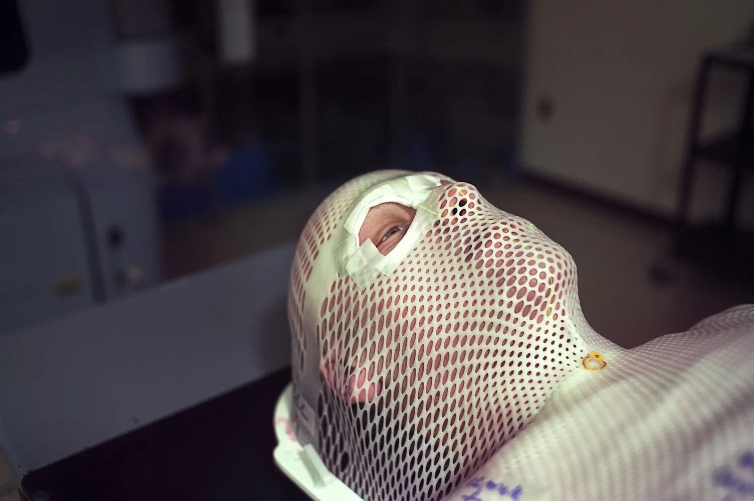  Mitch, preparing to undergo one of his radiation treatments. The "noninvasive mask" is custom fitted to Mitch's head in order to keep his head completely still while he is being treated. The holes allow for easier breathing, and is thought to help e