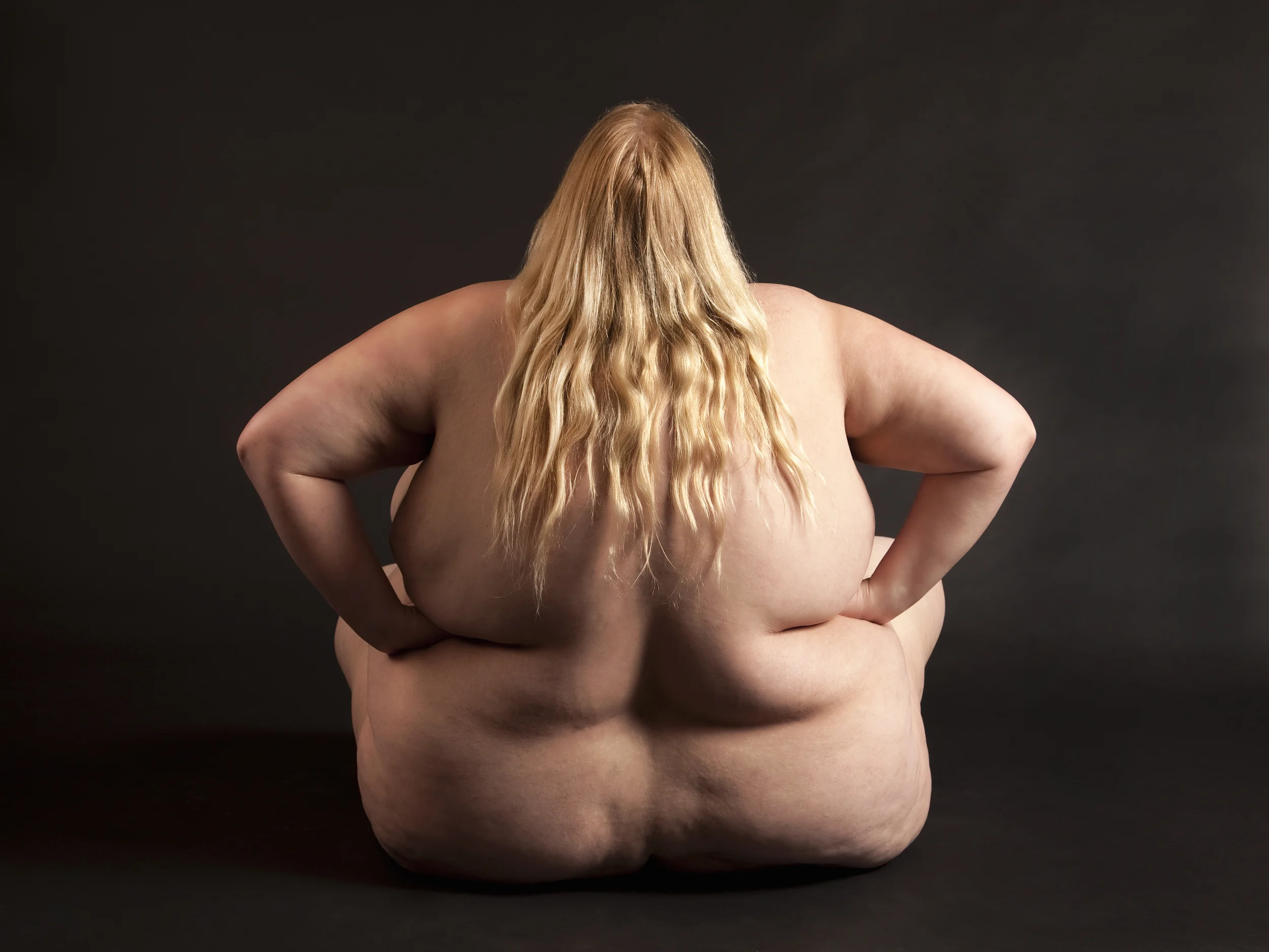 Det er din egen skyld at du er tyk!