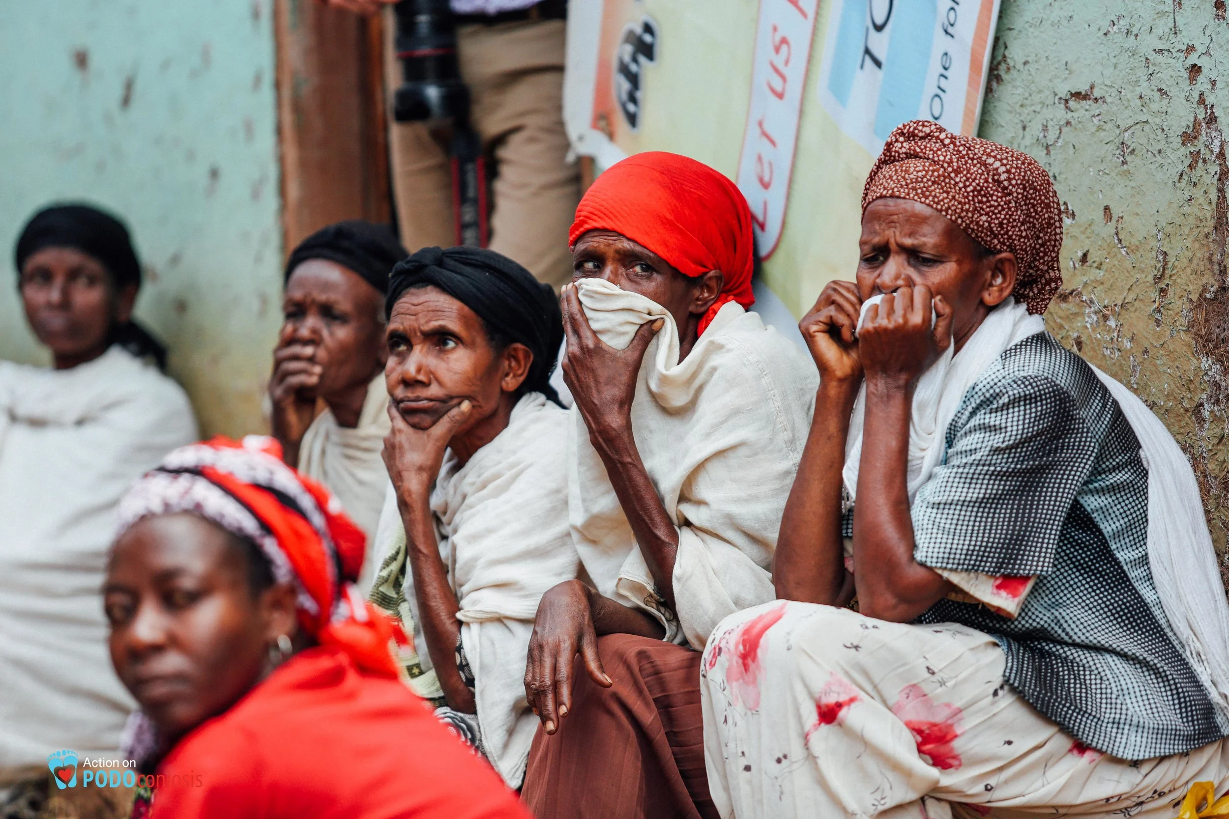 The smell of podo can be very unpleasant and, in extreme cases, unbearable.