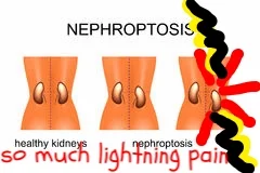 kidney.jpg