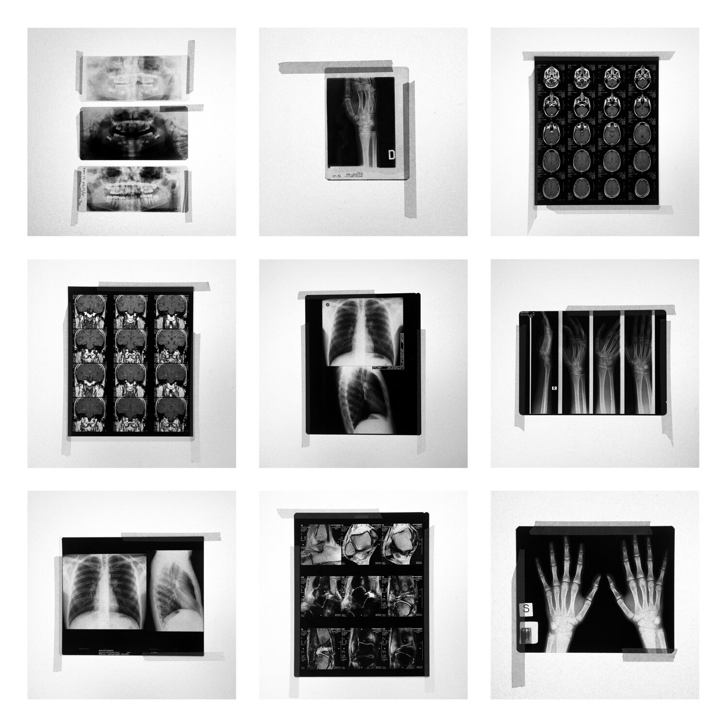       Fragile (a) Collection of my x-ray and MRI 1989 - 2016 Rome / Cairo    Digital files      