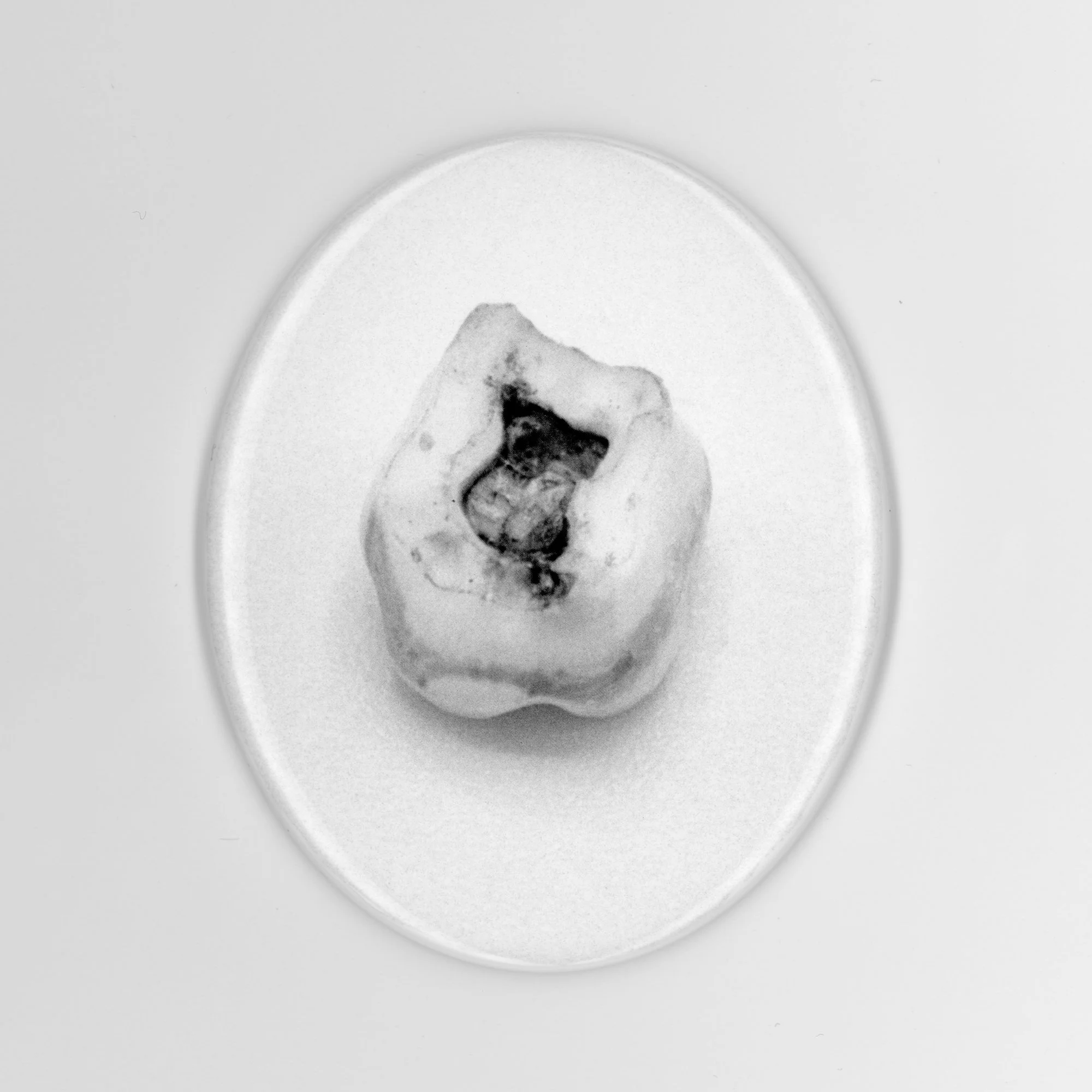     Deciduous teeth (a1) Deciduous tooth - ¼ - 198X - 199X  2019 Rome      