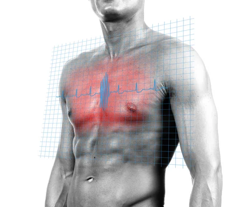 CardiovascularDisease1815254.jpg