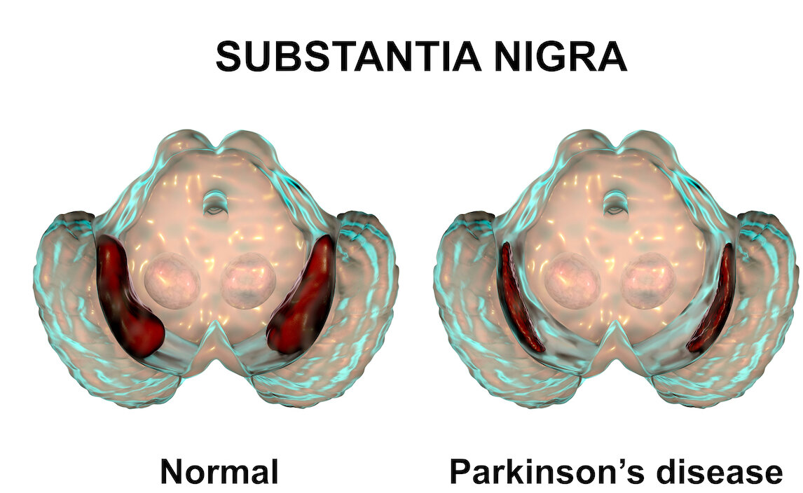 Parkinsons banner.jpeg