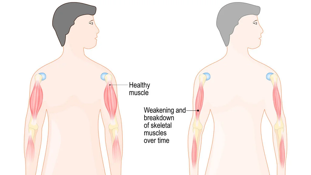 musculardistrophy.jpg