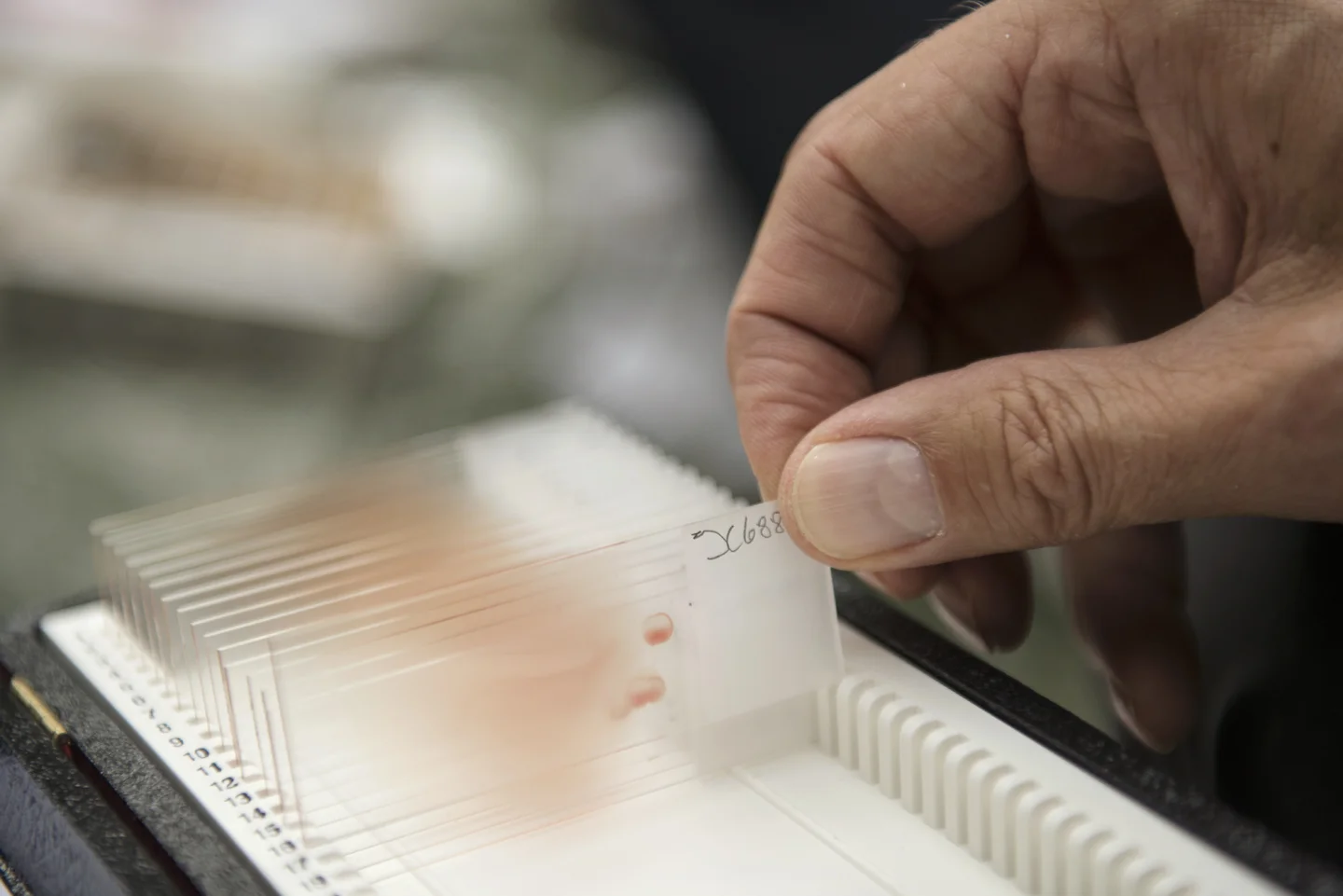 The blood slides, samples and data are used by Dr. Kenntner, NABU Berlin and the Leibniz Institute to gain a better understanding of the health of Berlin's goshawk population