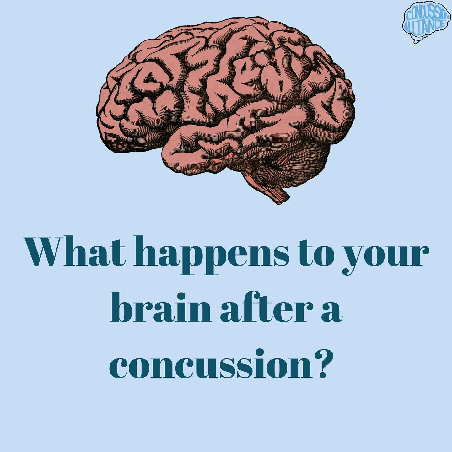 Helpful info about what a concussion is, what causes a concussion, and what happens to your brain after you get a concussion. Link in bio. @elenamoralesgrahl @car0line.saksena .
.
.
.

#concussion #concussions
#concussionssuck #concussionrehab #concu