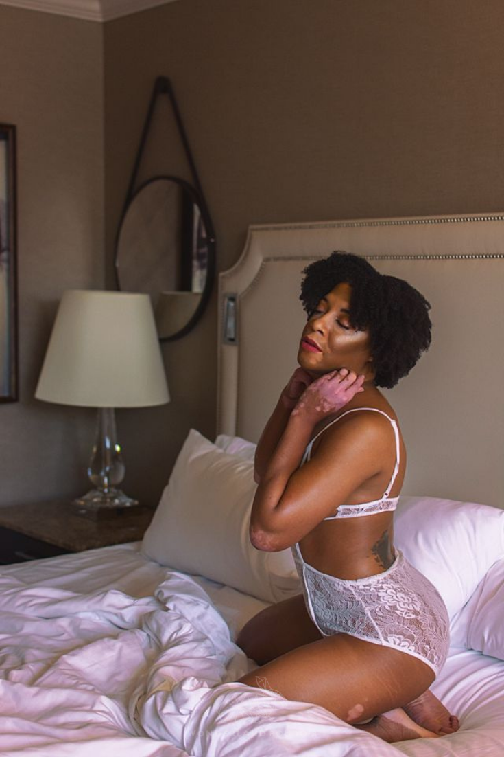 Dallas Boudoir White Lingerie Vitiligo Model (2).png