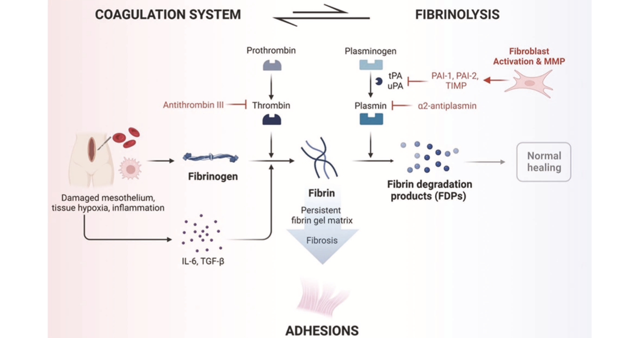    A DEVELOPMENT ROADMAP TOWARD ABDOMINAL ADHESIONS PREVENTION TECHNOLOGIES    Christensen, R.R.; Wright, K.E.; Ives, J.K.; Minnick, C.E.; Chen, Q.; Girgis, M.D.; Ko, C.; Gibbons, M.M.; Russell, T.A.; Huy, T.S.; Bercz, A.; Smith, J.J.; Bailey, A.; te
