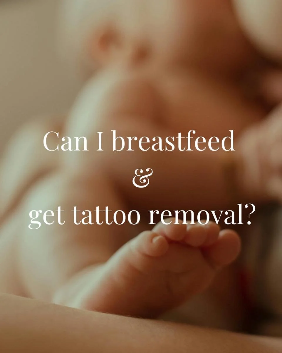 Can You Get Laser Tattoo Removal While Breastfeeding?

Laser tattoo removal is generally not recommended while breastfeeding. The main concerns are:
	1.	Toxin Release &ndash; The laser breaks down tattoo ink into tiny particles that the body eliminat