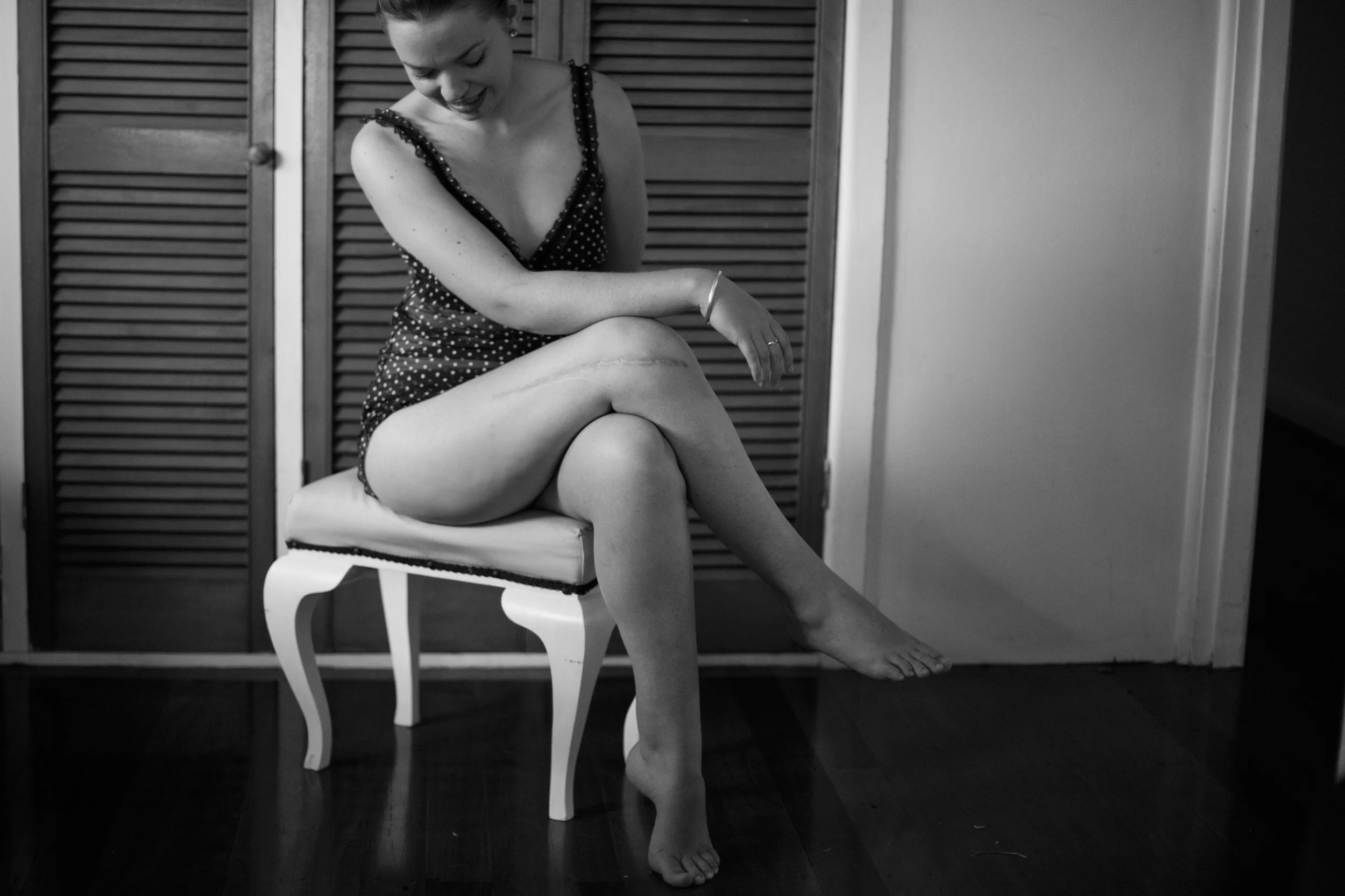 Scar Stories Jasmine Bone Cancer2.jpg