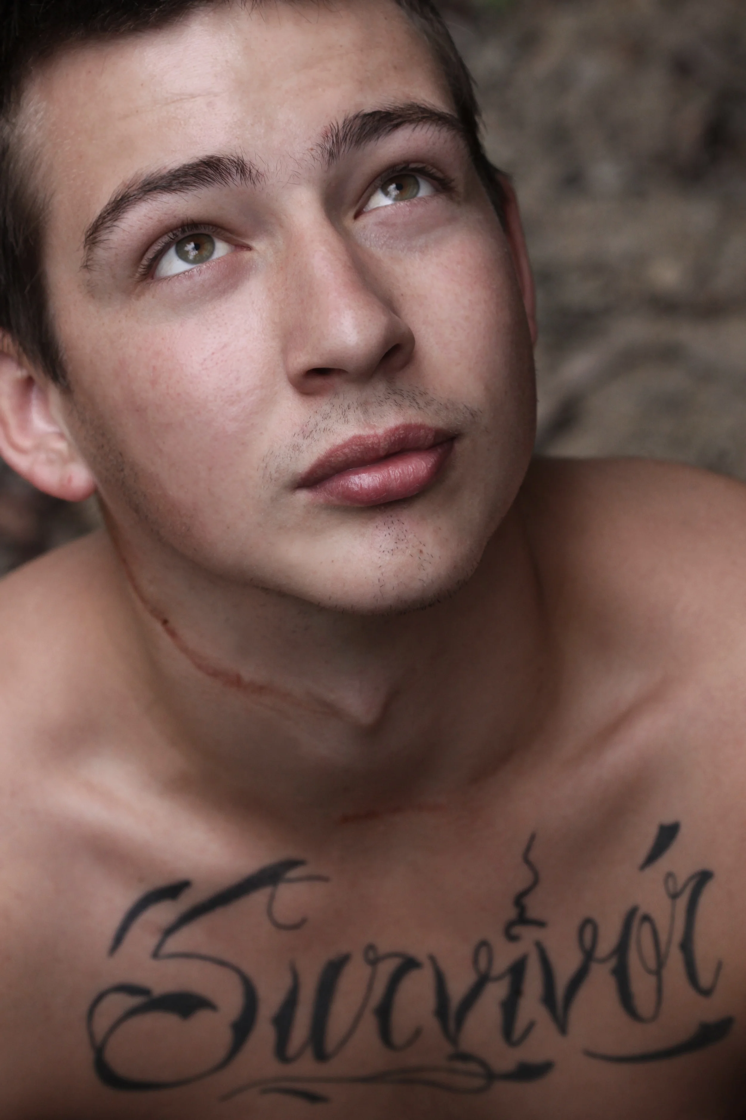 Scar Stories Brandon Osteosarcoma by Lisa Auger.jpg