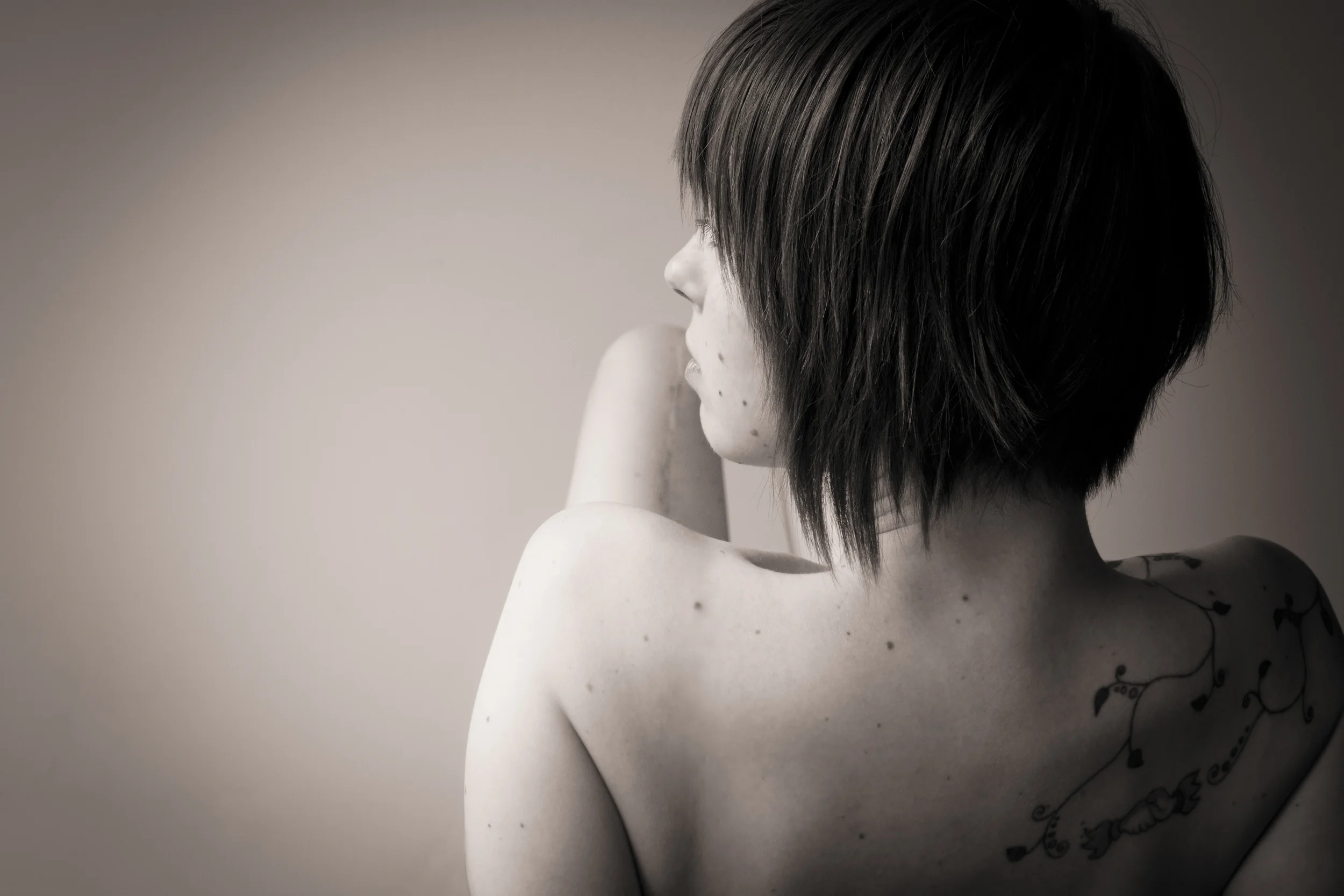 Scar Stories Lucy Ewings Sarcoma by April Kendall.jpg