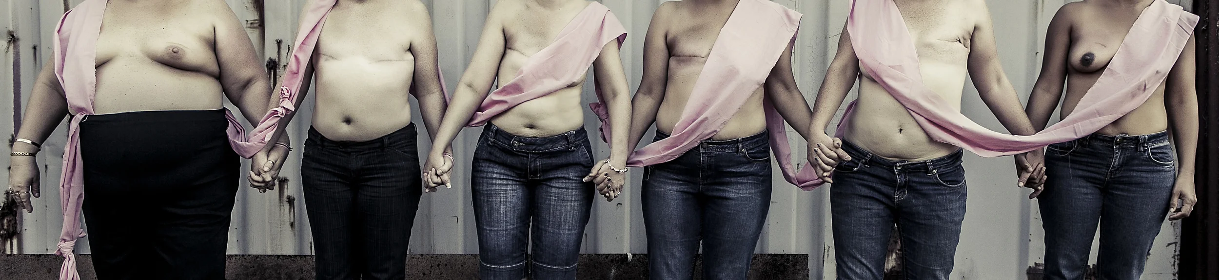 Scar Stories TBC Breast Cancer by Suzanne McCorkell.jpg