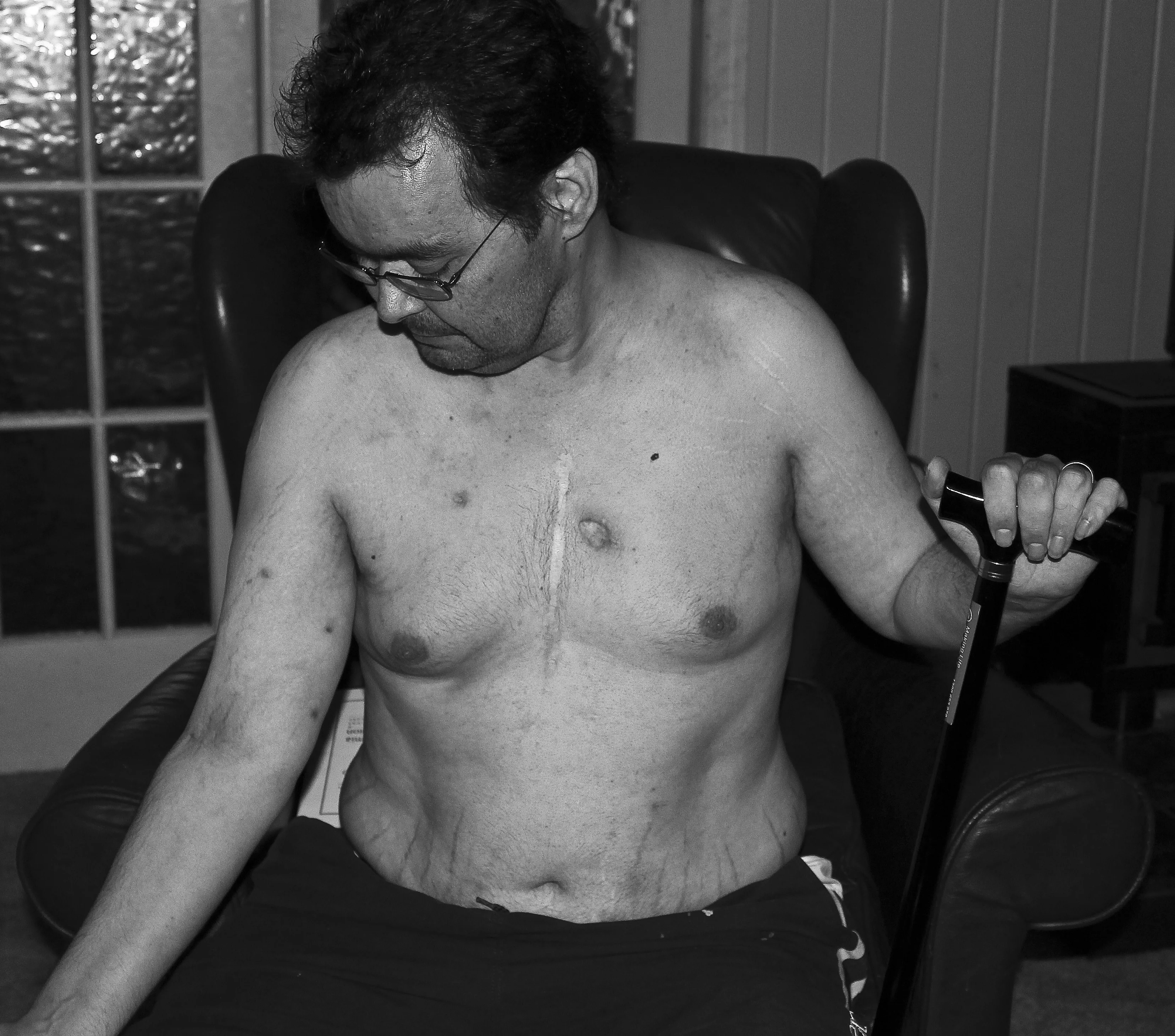 John, Non-Hodgkin's Lymphoma, by Michelle Watters