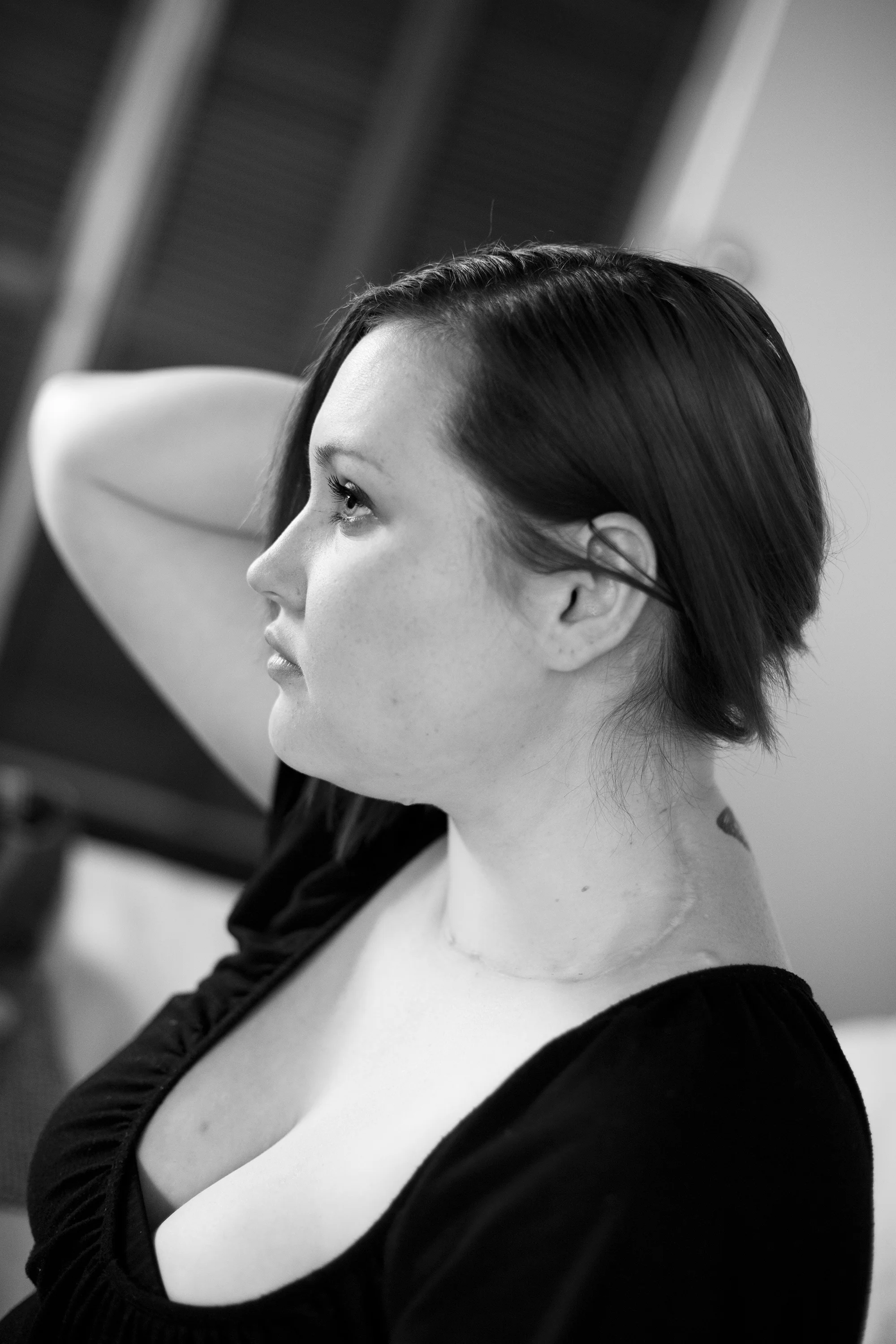 Ashleigh, Papillary Thyroid Cancer, by Georgia Brizuela