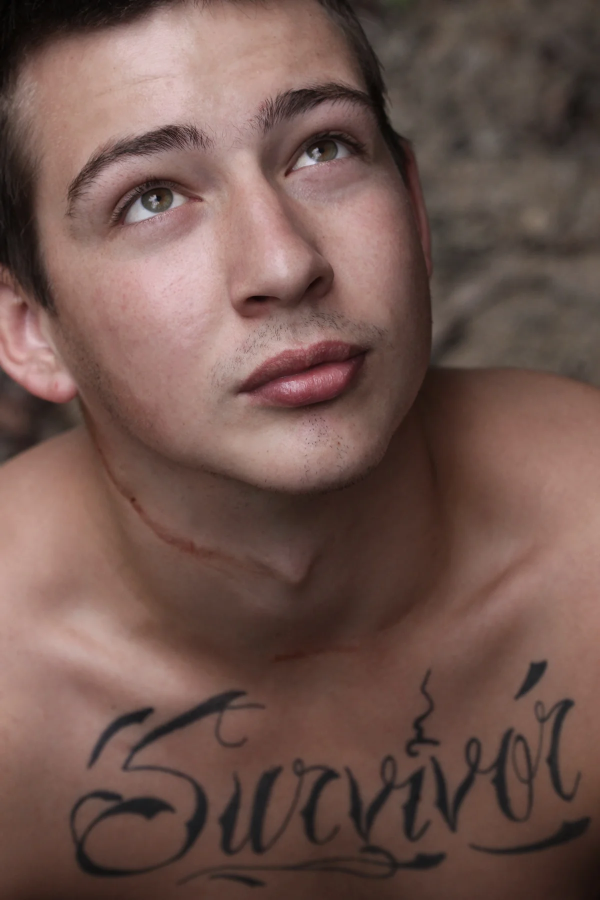 Brandon, Osteosarcoma, by Lisa Auger