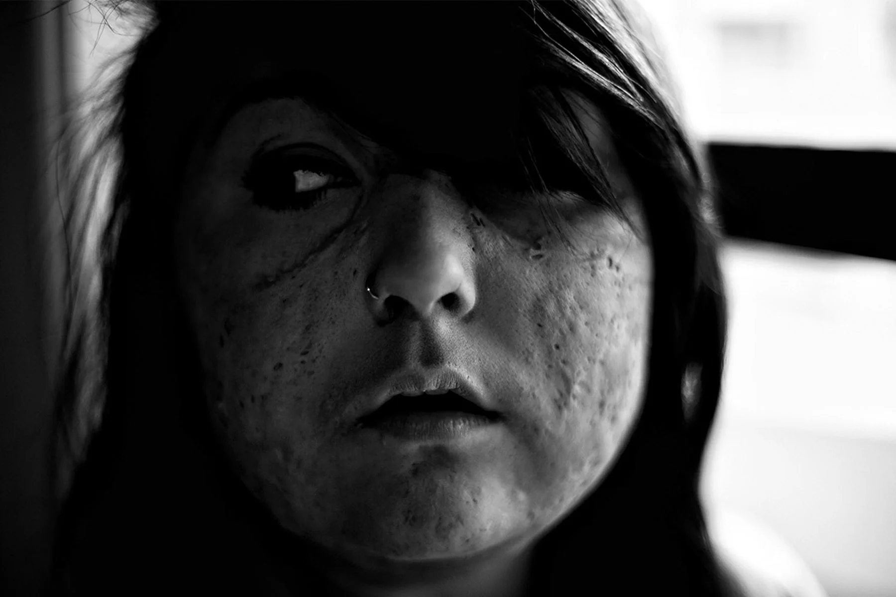 Michaela, Stomach Cancer, by Thomas Webb & Angelo Kehagias