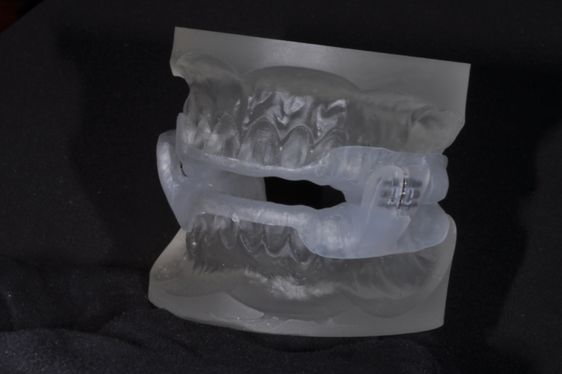 ZQUIET PROFLEX Dental Ceramics Ohio.png