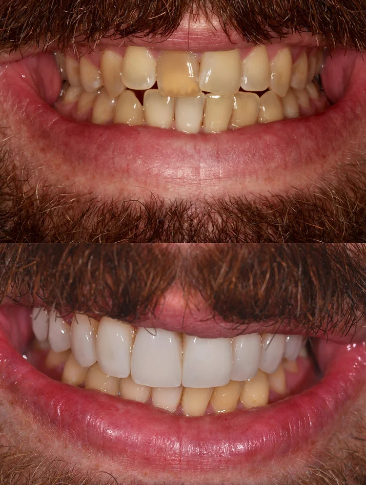 Andy Before & After