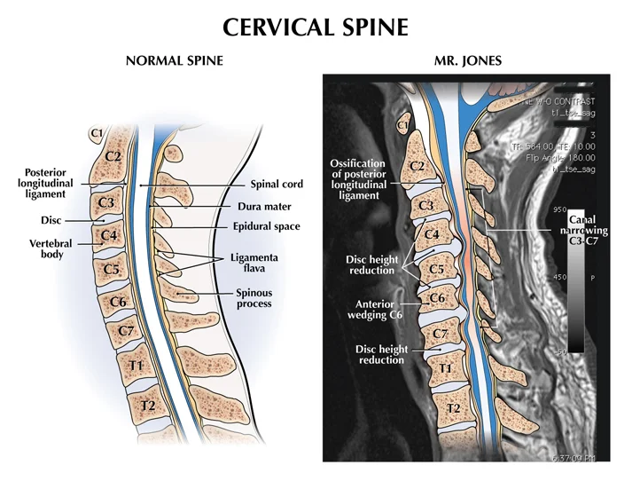 xraycervical.jpg