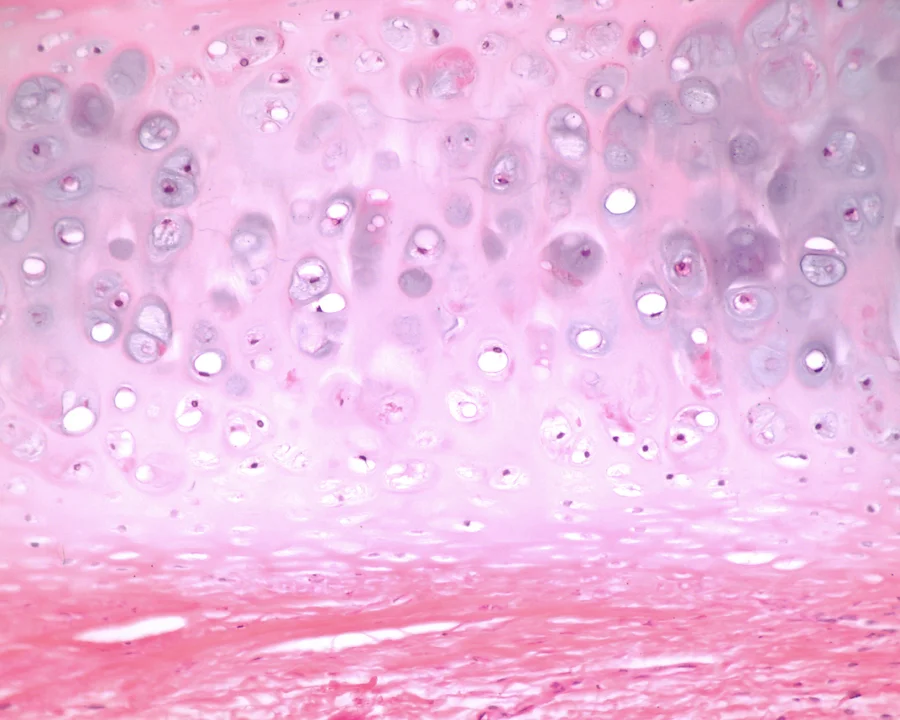  "Magenta makes me puke.", II 