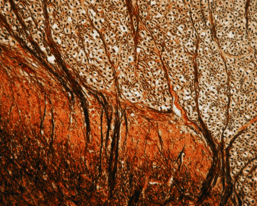  "There are people in the world who’ve never even heard of Mormonism and they seem to be doing just fine.", IV 