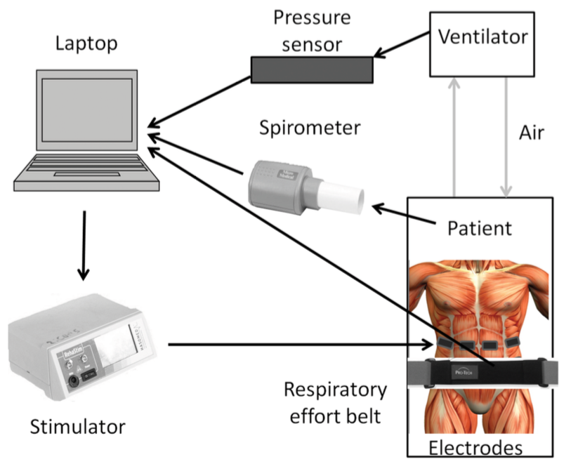 A system diagram with the RehaStim 1 FES Unit from Hasomed GmbH