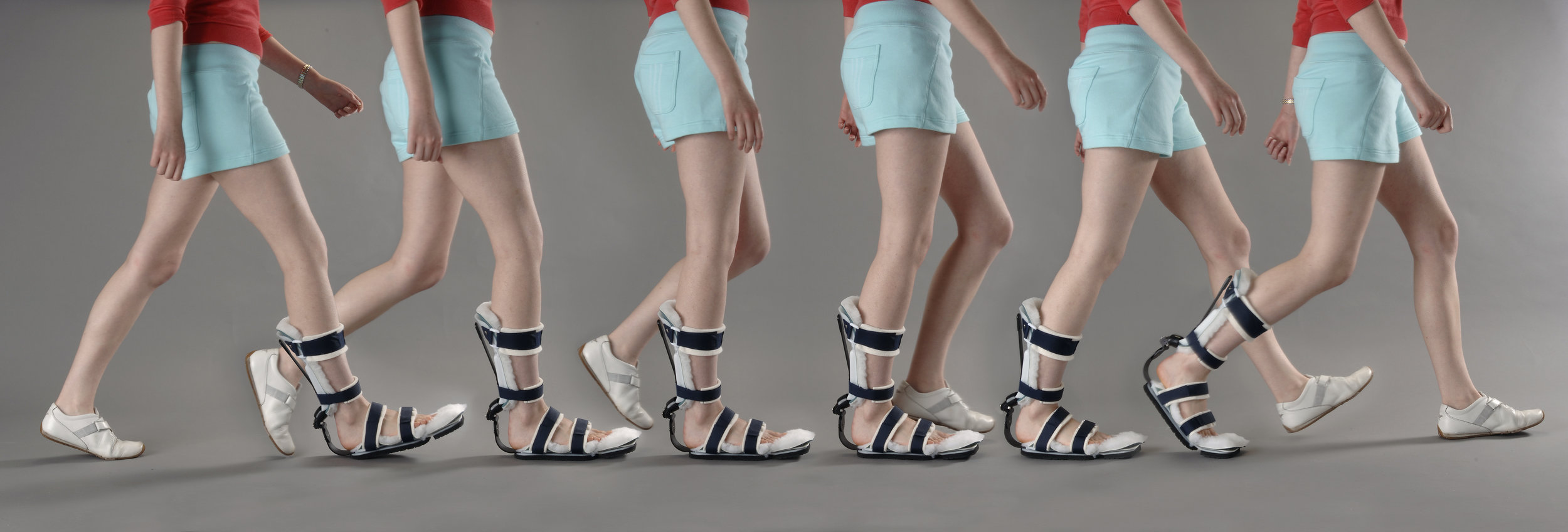 PRAFO Ankle Foot Orthosis with Optional Pad & Strap Kit allows protected ambulation