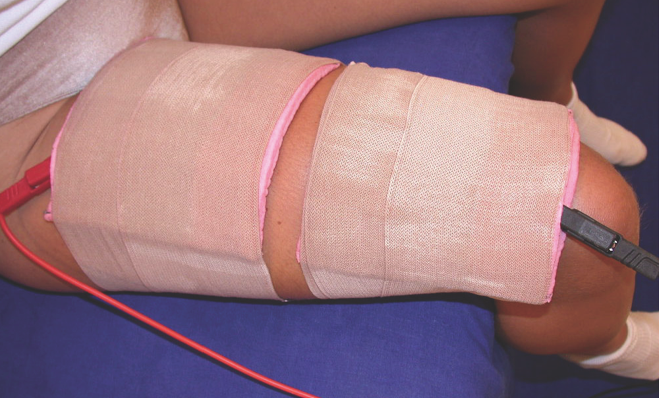 We may use large conductive carbon and wet sponge electrodes