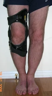 Mr MD in V-VAS orthosis
