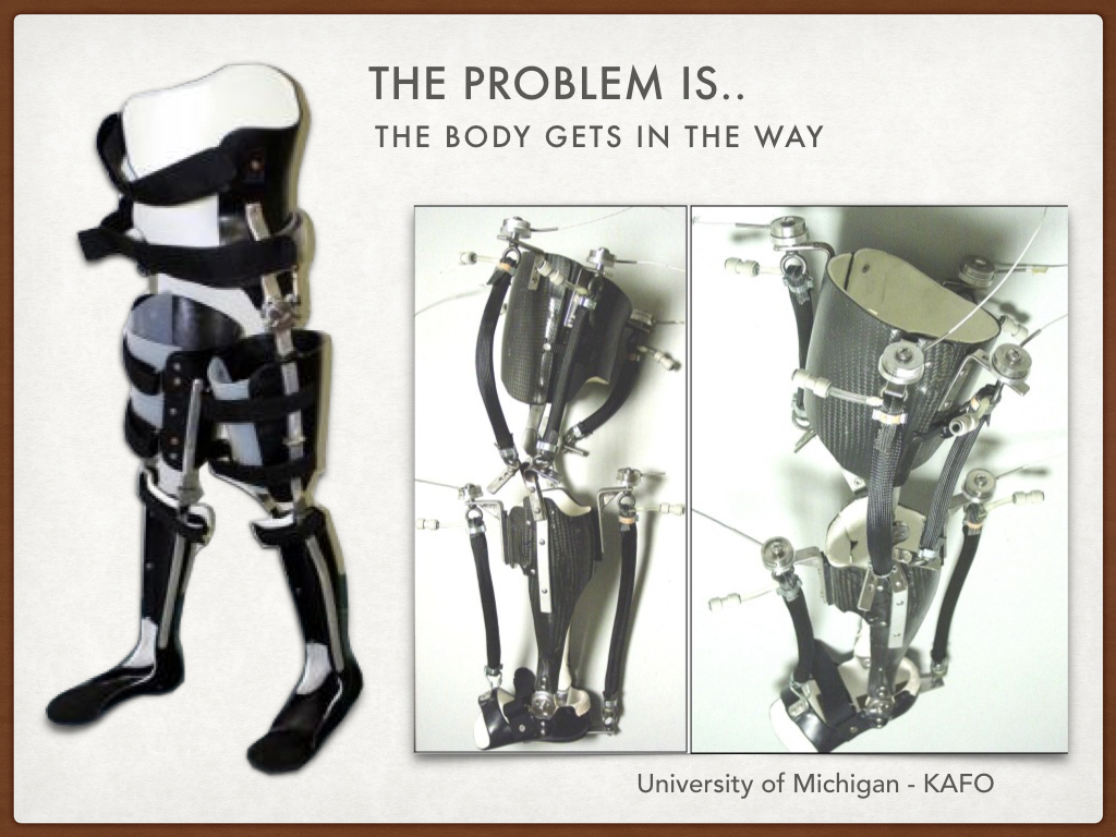 Lower Limb Technology advances - Irwin Mitchell More Rehab.023.jpeg