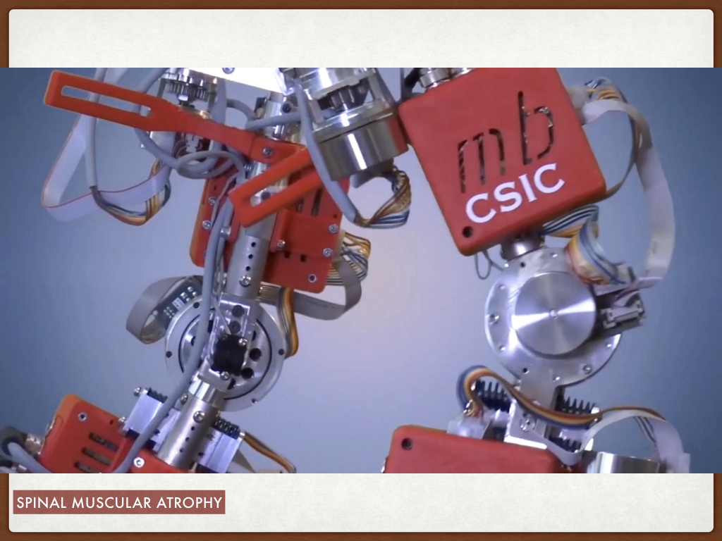 Lower Limb Technology advances - Irwin Mitchell More Rehab.024.jpeg