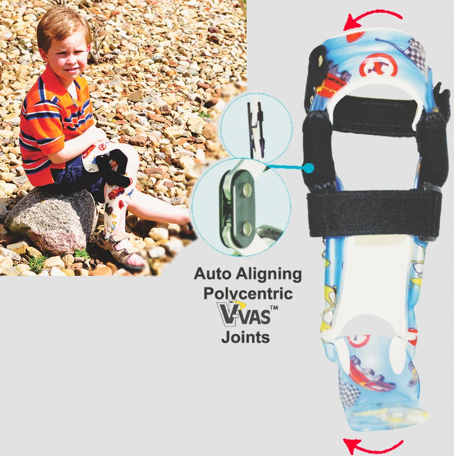 The Blounts orthosis incorporates the Unique V-VAS joint to apply and control a gentle corrective force