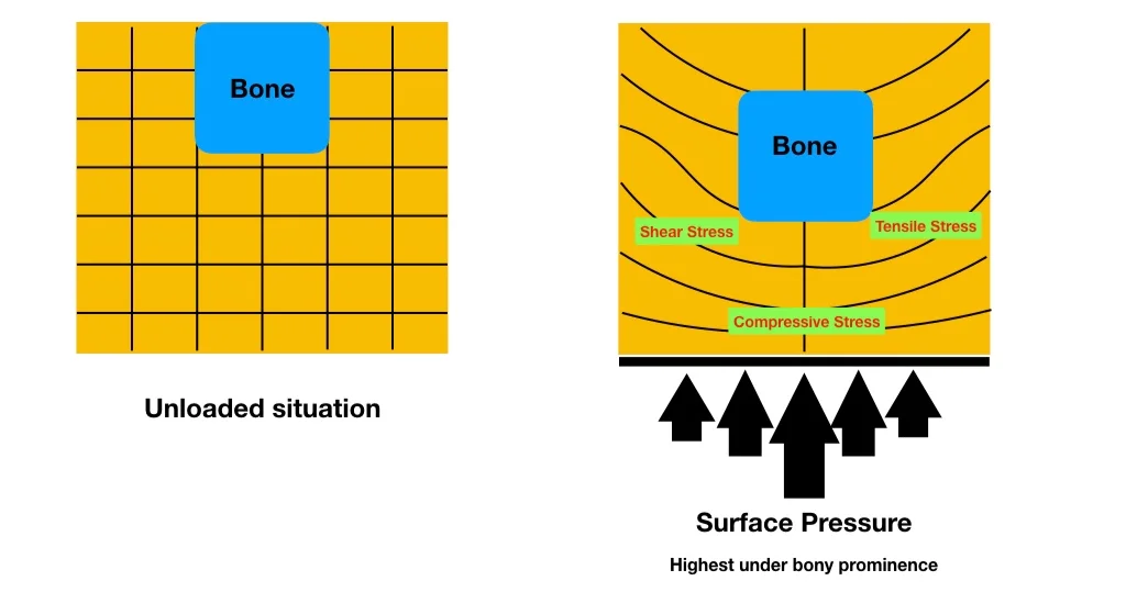 Pressure applied to tissue causes complex patterns of shear effects