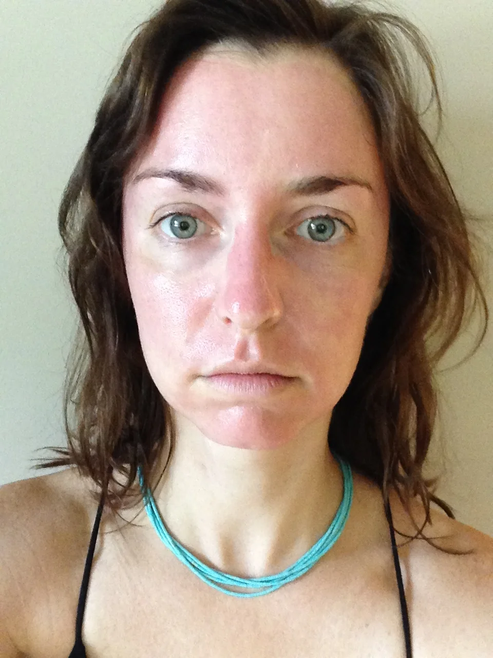 Immediately following procedure - red for less than 24 hours