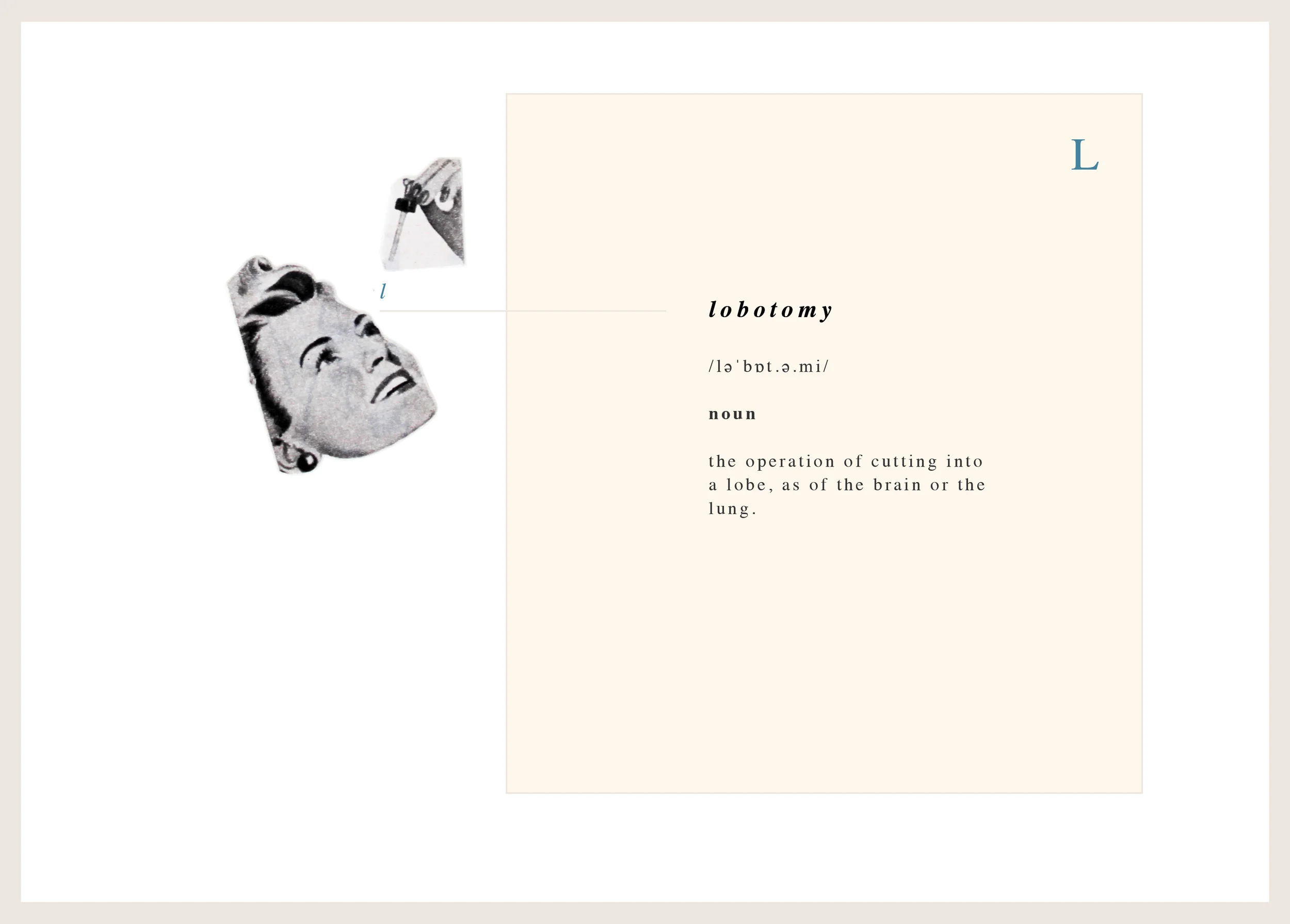 beitz_dict_lobotomy.jpg