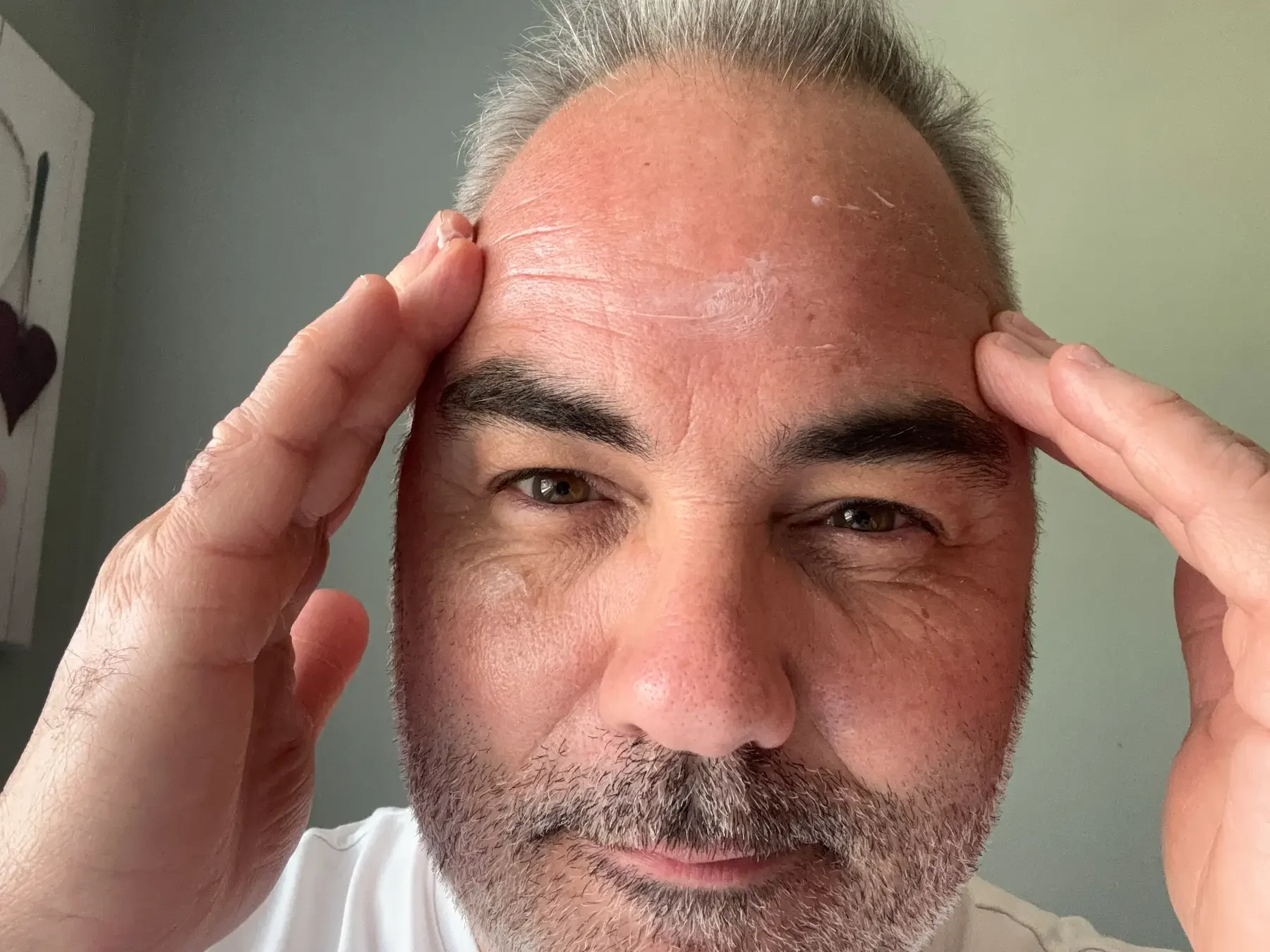 Jerome applying Horace Rich Face Moisturizer to his forehead during daily skincare testing.