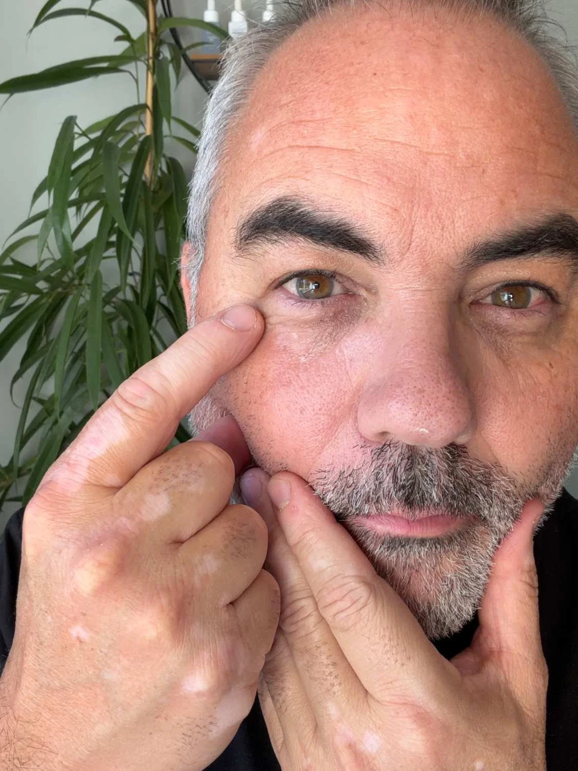 Jerome applying The Ordinary Lacto-PDRN 4% + B9 Eye Cream beneath his eye with a fingertip.