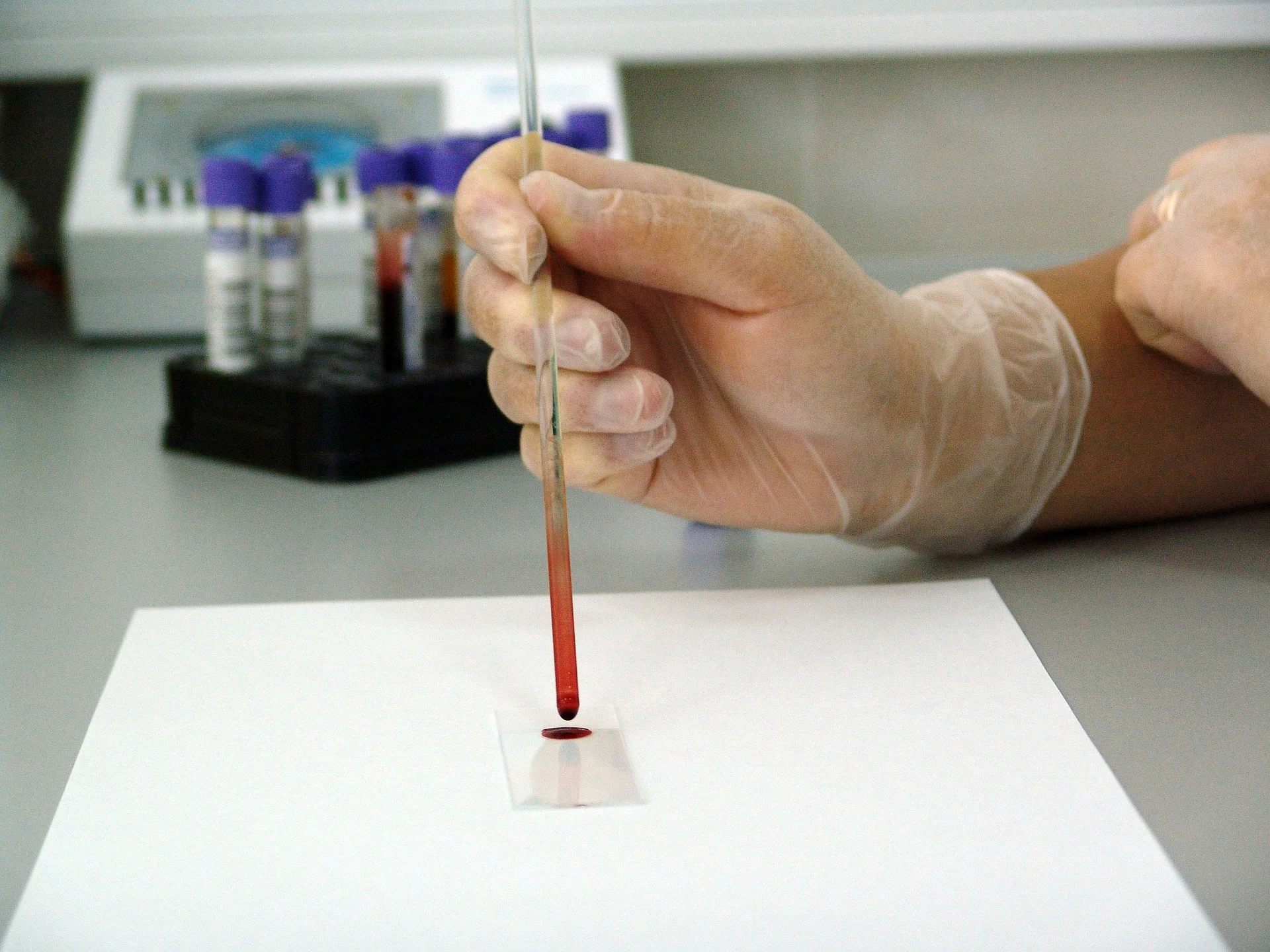 blood-17305_1920.jpg