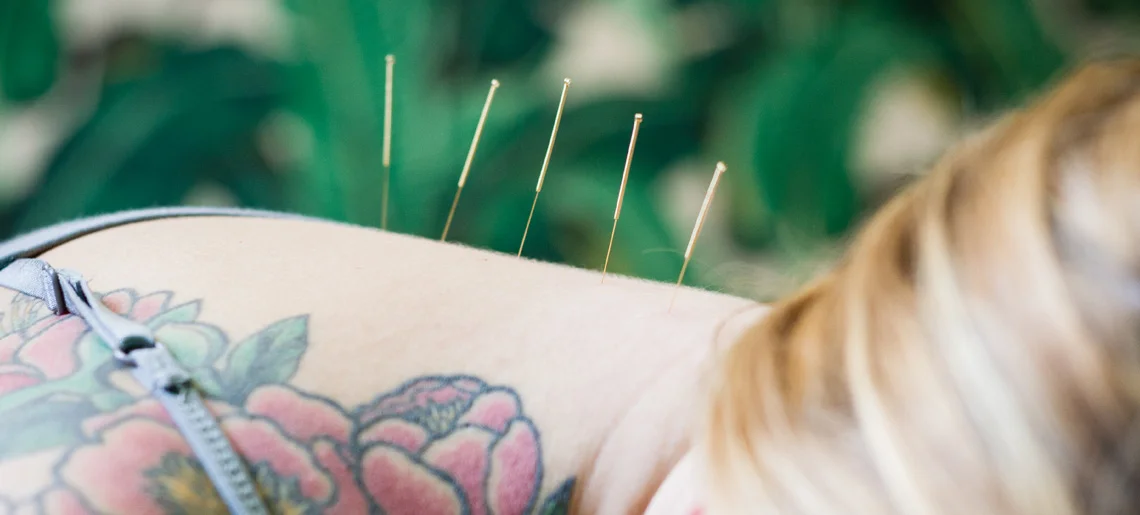 About-acupuncture.jpg