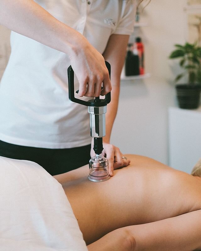 ⠀
🥁 Introducing 🥁 ⠀
⠀
Myofascial Cupping! ⠀
⠀
I&rsquo;m super excited to add cupping to my list of treatment options 😁. It&rsquo;s a technique that I&rsquo;ve been using as self-care for a while now, and I love it! So I recently decided to get cer