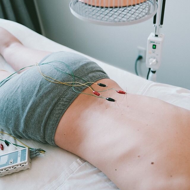 ⠀
Have you tried Electro-Acupuncture yet?&nbsp;⠀
⠀
Electro-Acupuncture treatment uses a pain free electrical current ⚡️ to stimulate the nervous system 👉🏻 promoting healing, decreasing pain, reducing inflammation, relaxing muscles, and normalizing 