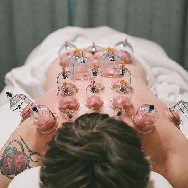 Gotta do my part to make sure this guy stays in cycling shape! ⠀
⠀
🚴🏼💪🏼⠀
⠀
Want to give cupping a try? We can include it in any treatment anytime. Just ask!!⠀
⠀
⚪️🔴🟣🔵